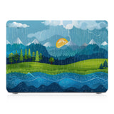 MAC-BDMOUNTAINCARTON-04