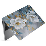 hardshell case with Flower Art design has matte finish resists scratches