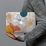 hardshell case with Spring design combines a sleek hardshell design with vibrant colors for stylish protection against scratches, dents, and bumps for your Macbook