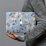 hardshell case with Spring design combines a sleek hardshell design with vibrant colors for stylish protection against scratches, dents, and bumps for your Macbook